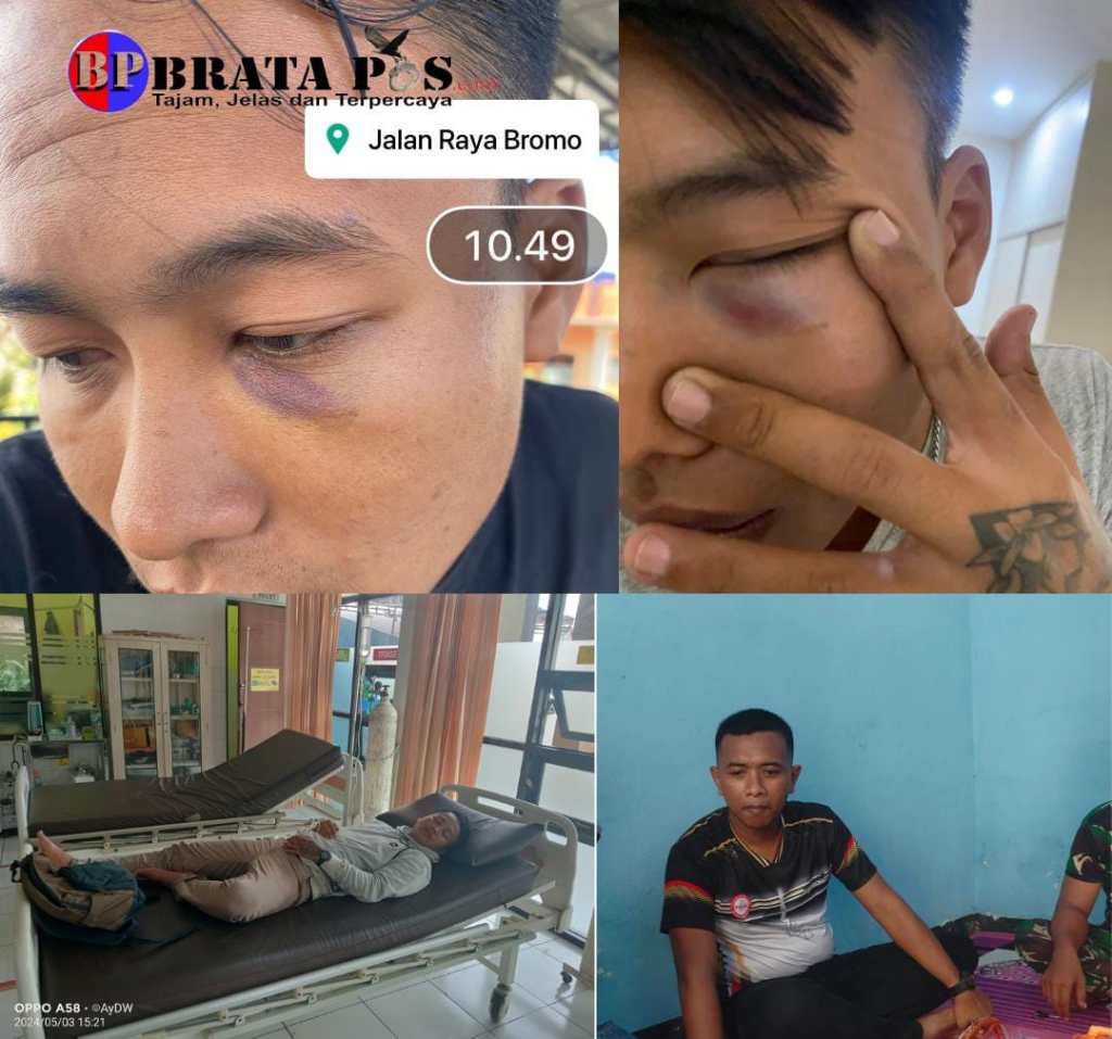 Pengakuan Korban Terima Bogem Mentah Dari Oknum Anggota TNI, Begini Endingnya..!